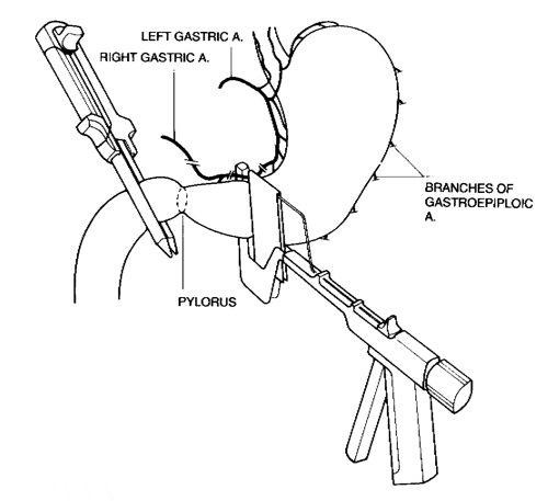 atf034m.gif